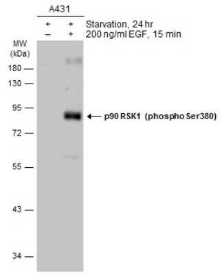 <b>Biological Strategies Validation. </b>Western Blot: RSK1 [p Ser380] Antibody [NBP3-13243] - Untreated (-) and treated (+) A431 whole cell extracts (30 ug) were separated by 10% SDS-PAGE, and the membrane was blotted with RSK1 (phospho Ser380) antibody (NBP3-13243) diluted at 1:1000. The HRP-conjugated anti-rabbit IgG antibody (NBP2-19301) was used to detect the primary antibody.